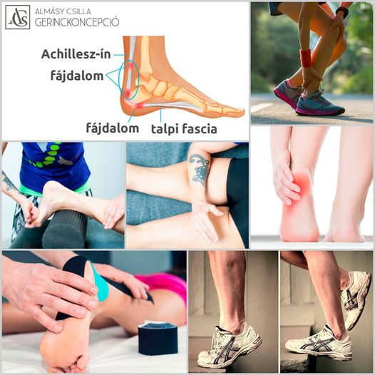 🦶 ACHILLESZ-ÍN ÉS TALPI FASCIA KAPCSOLATA