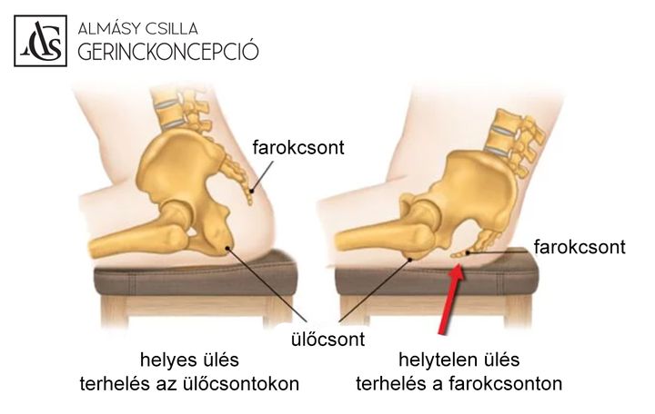 FAROKCSONTI FÁJDALOM A gerinc legalsó része a pár cm nagyságú farokcsont, ami 4-6 összecsontosodott,…